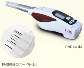 FNS